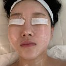 수성구 이중턱 개선 범어동 피부관리실 이조에스테틱 업모드 윤곽 리프팅 상세후기