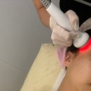 세븐일레븐 동대구1호점 | [대구신부관리] 뷰티로다 동대구점에서 수기+리프팅관리까지 작은얼굴관리 받은 후기