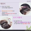 수원탈모 홈케어 실패 후, 아미치0.3 수원점에서 찾은 맞춤 관리 후기