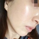 라띠에라 환절기 피부고민 끝! 위치하젤&amp;티트리 킹덤 로션으로 피부 고민 싹~!