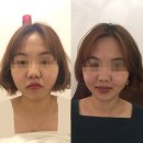 나비 테라피