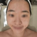 선인메디칼 | 드림뷰티 신정마을점] 겨울철 건조하고 칙칙한 피부에 저자극 모공관리 받고 새피부로 다시 태어난 후기!