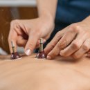 한나라한의원 | 뜸, 혈액순환 개선과 피로 회복 비법