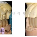 샤인 치과기공소 이미지