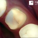 대림치과기공소 이미지