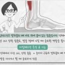 아킬레스건 통증 원인 및 과 : 파열 염증(아킬레스건염) 이미지