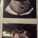 과천시보건소 | 봄빛병원 임신확인 첫진료 과천시 보건소 임신 선물