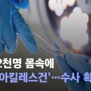 최소 2천명 몸속에 '반쪽 아킬레스건'…수사 확대 / JTBC 뉴스룸 이미지