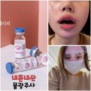 진의원 | 내돈내산 릴리이드 물광주사 리쥬란hb 비교 속건조 스킨부스터