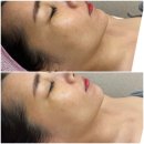세이에너지 | [수완지구피부관리] 세이뷰티에서 경험한 인생관리 광주 피부관리 믿고 받는 곳 추천
