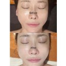 청담동 에스테틱 강남신부관리 뷰티블르바드 화이트닝 후기