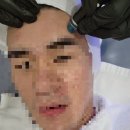 안강제일의원 | 다산동 피부과 여드름 염증 피지 관리 in 아쥬르의원