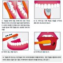 부정교합의 종류와 원인 이미지