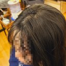 [서울 강서구/마곡동] 밀도보강SMP 정수리 가르마 커버 무통 SMP 맛집 &#39;퀀텀 SMP&#39; 찐 후기 !