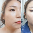 영앤미피부관리실 | 안산 피부관리실 실력좋은 핸들링에 반할 수 밖에 없더라