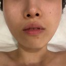 여우미인 | 논현 피부관리 여우미인 트러블압출잘하는곳 LDM 수분관리 예신 웨딩관리