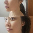썸체형관리 이미지