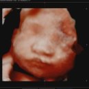 아이제일산부인과의원 이미지