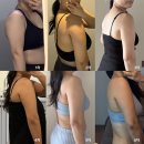 라인6차 | 지분주사 바디라인관리 이오팻 6차 마지막 후기, 팔뚝라인변화 전후 총정리