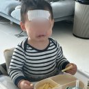 우리에게도 찾아온 돌발진(돌레)🤒 481일~485일 육아 기록