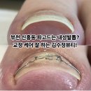 메디페디인천 | 부천 신흥동 파고드는 내성발톱은 교정 케어 잘 하는 김수정뷰티!