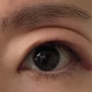 탐의원 | 내돈내산 아이라인 문신 제거 후기, 비용, 통증, 1-5일차 리얼 과정