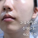 페페네일 | 강남리쥬란힐러 4cc 수면마취 후기, 효과, 유지기간, 전후