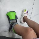 5월 일상2(따님 깁스하다! 니는 드디어 흑자 제거! 대구 리팟레이저 가격)