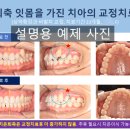 웃는E치과교정과치과의원 네이버블로그