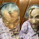 이마 이미지