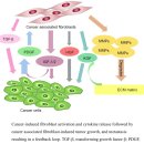 Re:Cancer associated fibroblasts: An essential role in the tumor microenvironment 이미지