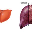 B형 간염 전염경로 이미지