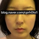 잠실새내 윤곽관리 핫탄스파 잠실점, 1회만으로도 갸름해지는 송파 윤곽관리 찐후기