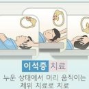 회전성 현기증 원인 이석증 알아보자 이미지