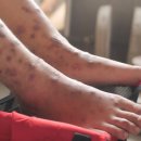 온누리민우약국 이미지