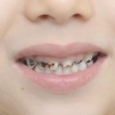 피노키오치과 이미지