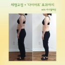 지나얼라인
