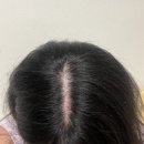 엘시티리턴의원 이미지