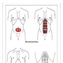 Rectus Abdominis (복직근) 이미지