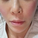 우라질 | 50대 갱년기 초기증상,50대 체중증가 다이어트목표,이석증 치료후기,