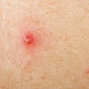 비바의원 이미지