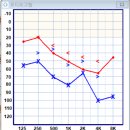 다비치히어링 대전역점 이미지