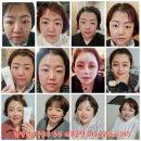 선한 인셀덤 이미지