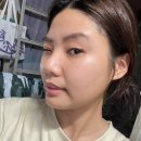 강화최씨 열녀각 | 모공 줄이는법 시술 숙빈최씨미안법 비교