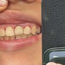 마일스톤즈치과의원 이미지