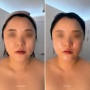 경북일고등학교 건너편 | 구미 인동 피부관리 추천 희뷰티 크레이지015 윤곽관리 후기