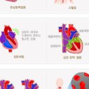 심부전 및 원인 심부전증 방법은 이미지