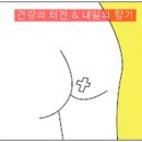 항문질환 - 추운 겨울에 악화되는 치질 왜? 이미지