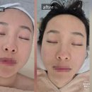 스토리샵 | 동탄에스테틱, 동탄피부관리샵 스킨스토리에서 작은얼굴 관리 받고 온 후기(1회만으로도 효과있음)
