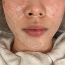 더벨르 | 더왁싱&amp;더태닝 동탄점 벨르업 리프팅 동탄 피부관리 후기